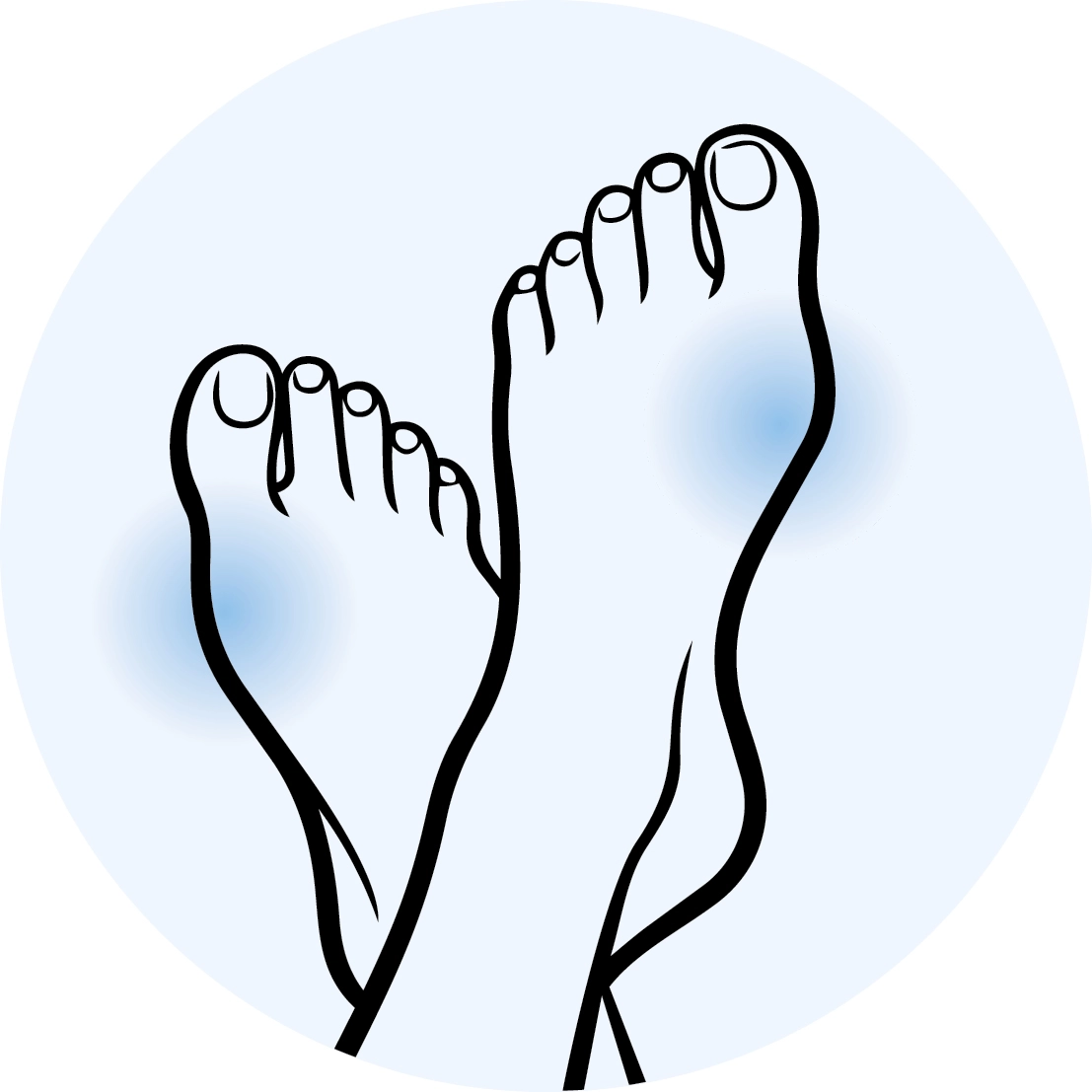 Hallux valgus